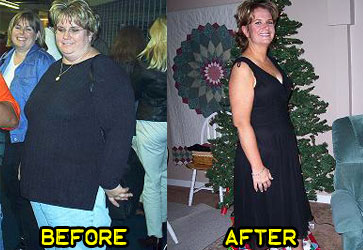 lori-weight-loss-story-1