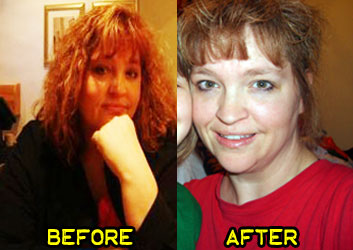 florence-weight-loss-story-3