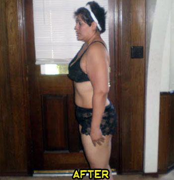 debbie-weight-loss-success-story-2