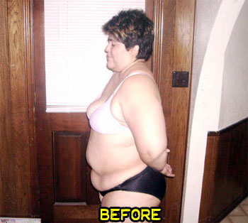 debbie-weight-loss-success-story-1