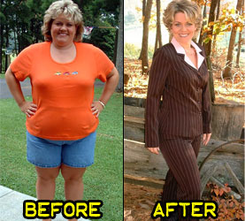 carla-weight-loss-story-1