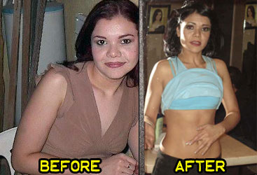 ana-weight-loss-story-2