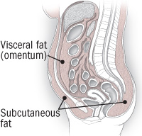 illustration of abdomen showing visceral and subcutaneous fat