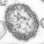 measles-virus-wikipedia