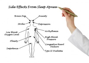 Obstructive Sleep Apnea