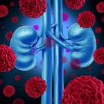 Over one-third of lupus patients get lupus nephritis