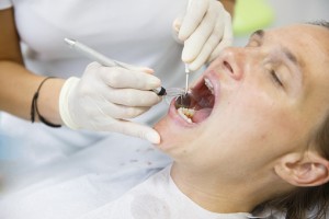 Psoriasis-affected people face increased risk of gum disease (periodontitis): Study
