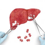 Alcoholic liver disease prevention