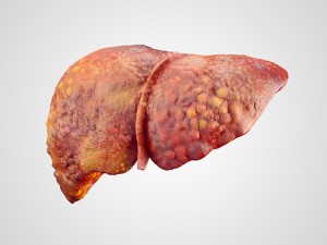 Liver Fibrosis