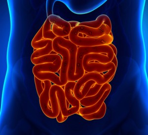 Crohn’s disease vs. diverticulitis: Causes, symptoms, risk factors, and complications