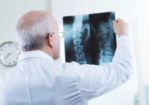 Factors that lead to bone loss 