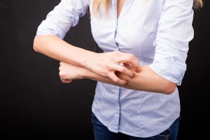 Psoriasis and psoriatic arthritis symptoms improved by bariatric surgery