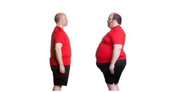 weight-loss-surgery