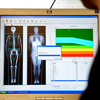 best worst measure body fat dexa scan