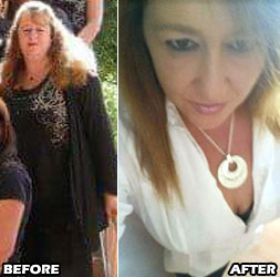 lynn-w-weight-loss-story-2