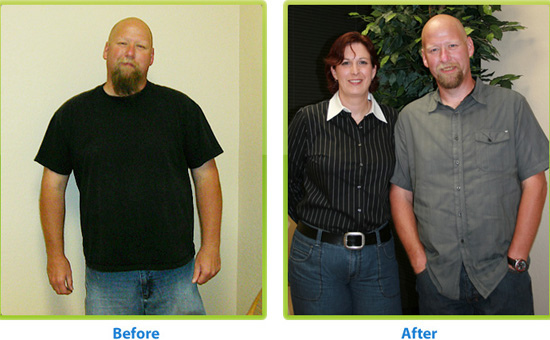 Losing Weight Doesn’t Have To Be A Battle